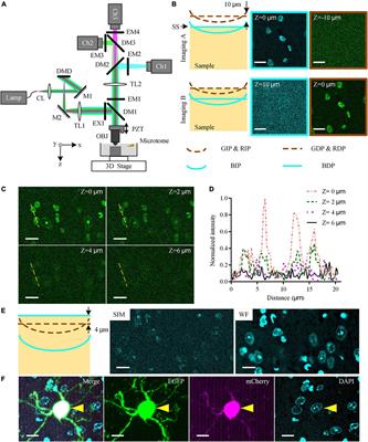 Multicolor high-resolution whole-brain imaging for acquiring and comparing the brain-wide distributions of type-specific and projection-specific neurons with anatomical annotation in the same brain